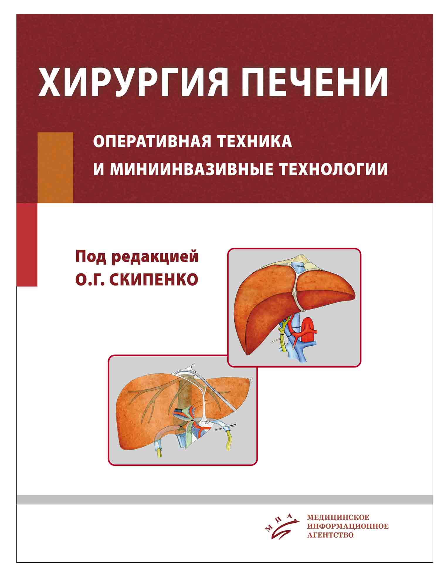 Хирургия печени. Оперативная техника и миниинвазивные технологии: Руководство для врачей - Скипенко О.Г. (978-5-9986-0268-9)
Хирургия печени. Оперативная техника и миниинвазивные технологии: Руководство для врачей - Скипенко О.Г. (978-5-9986-0268-9)