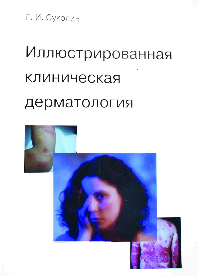 Суколин Г.И. Иллюстрированная клиническая дерматология (987-86021-124-4) Изд. Люкс-Принт
Суколин Г.И. Иллюстрированная клиническая дерматология (987-86021-124-4) Изд. Люкс-Принт