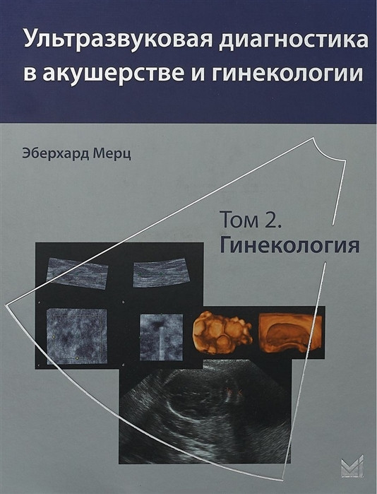 Мерц Э. Ультразвуковая диагностика в акушерстве и гинекологии. Том 2. Гинекология (978-5-00030-341-2) Изд. МЕДпресс-информ
Мерц Э. Ультразвуковая диагностика в акушерстве и гинекологии. Том 2. Гинекология (978-5-00030-341-2) Изд. МЕДпресс-информ
