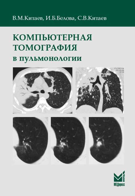 Китаев В.М. Компьютерная томография в пульмонологии 2019 год (978-5-00030-708-3) Изд. МЕДпресс-информ
Китаев В.М. Компьютерная томография в пульмонологии 2019 год (978-5-00030-708-3) Изд. МЕДпресс-информ