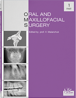 Oral and Maxillofacial Surgery Хірургічна стоматологія та щелепно-лицева хірургія. Ч.1. Видання 2. Маланчук В. О. та інші
Oral and Maxillofacial Surgery Хірургічна стоматологія та щелепно-лицева хірургія. Ч.1. Видання 2. Маланчук В. О. та інші