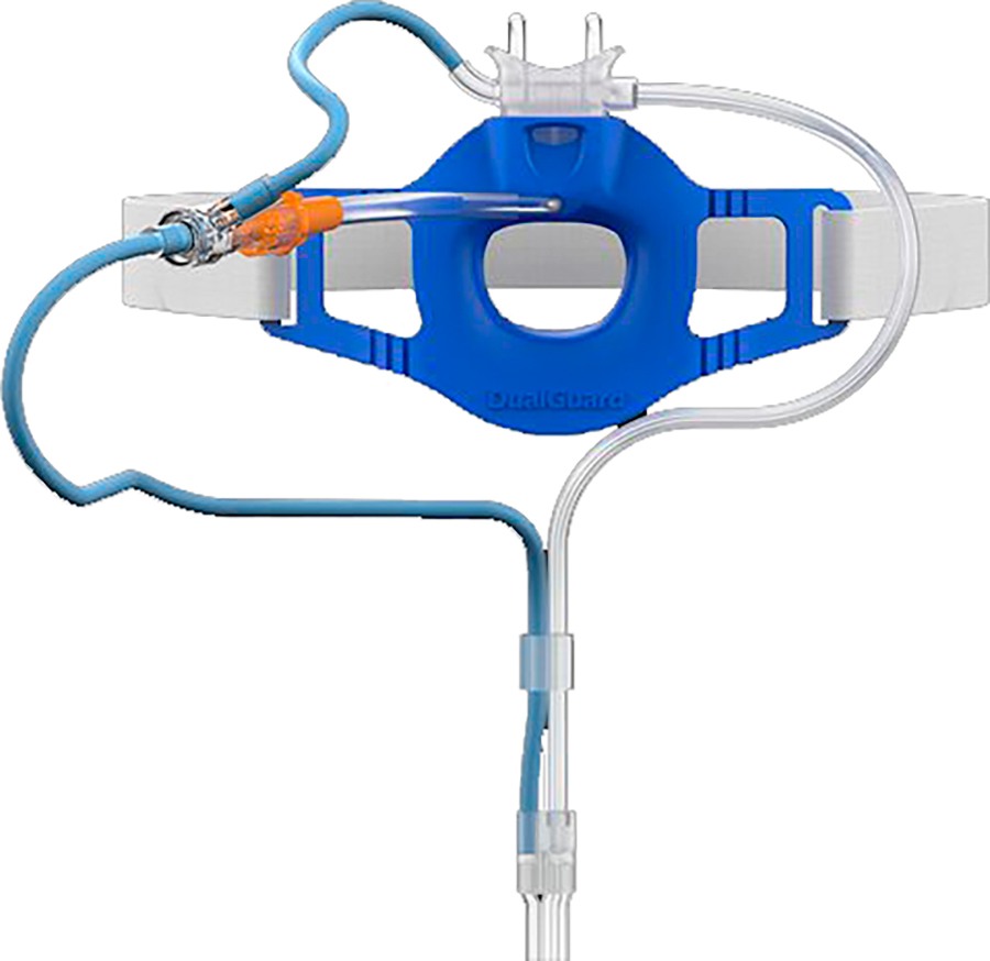 Система для эндоскопии Flexicare DualGuard линия 3 м, фильтр соединитель Luer Lock Female (032-10-860)
Система для эндоскопии Flexicare DualGuard линия 3 м, фильтр соединитель Luer Lock Female (032-10-860)
