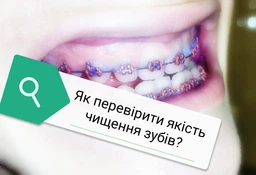 Таблетки для индикации зубного налета Curaprox двухфазнаые 12 шт (7612412199000) фото от покупателей 2