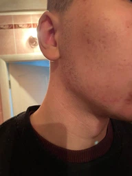 Миноксидил 5% Minoxidil KIRKLAND для роста волос и бороды ( 60 мл )