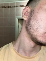 Миноксидил 5% Minoxidil KIRKLAND для роста волос и бороды ( 60 мл ) фото от покупателей 1