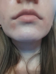 Набор La Roche-Posay Effaclar для проблемной кожи лица (5902503198114)