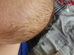 Дитячий регулювальний крем Uriage Baby Cradle Cap Skincare проти молочних кірочок 40 мл (3661434002502) фото від покупців 2