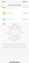 Зубна електрощітка Oclean X Pro Aurora Purple фото від покупців 3