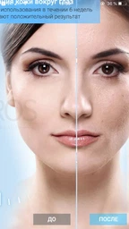 Массажер для лица микротоковый EYE ANTI WRINKLE Ms.W прибор для лифтинга и омоложения кожи вокруг глаз