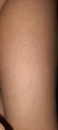 Фотоэпилятор PHILIPS Lumea Prestige BRI956/00 фото от покупателей 7