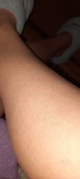 Фотоэпилятор PHILIPS Lumea Prestige BRI956/00 фото от покупателей 6