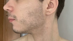 Міноксидил 5% Minoxidil KIRKLAND для росту волосся та бороди ( 60 мл ) фото від покупців 1