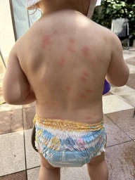 Солнцезащитное молочко La Roche-Posay Anthelios Dermo-Pediatrics для чувствительной и подверженной раздражению кожи младенцев очень высока степень защиты SPF 50+ 50 мл (3337872419904) фото от покупателей 1