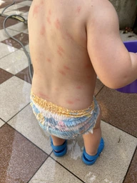 Солнцезащитное молочко La Roche-Posay Anthelios Dermo-Pediatrics для чувствительной и подверженной раздражению кожи младенцев очень высока степень защиты SPF 50+ 50 мл (3337872419904)
