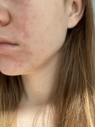 Интенсивная антивозрастная корректирующая сыворотка La Roche-Posay Ретинол Б3 против глубоких морщин, неровного тона и текстуры кожи лица 30 мл (3337875694469)