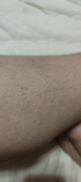 Эпилятор BRAUN Silk epil 9 SES 9/720 SensoSmart фото от покупателей 1
