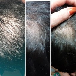 Лосьон мужской MinoMax 5% Hair Regrowth для восстановления и стимуляции роста волос 60 мл (4820175980015/4270001445872)
