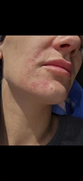 Успокаивающий крем Eucerin AtopiControl для атопичной кожи 40 мл (4005800076732) фото от покупателей 1