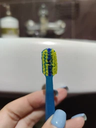 Зубная щетка Curaprox CS 5460 Ortho Ultra Soft Ультра-мягкая (CS5460 ortho-08) фото от покупателей 2