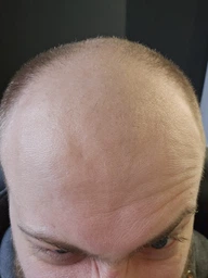 Шампунь для волосся відновлюючий, від випадіння Daeng Gi Meo Ri Vitalizing Shampoo, 7 мл фото від покупців 8