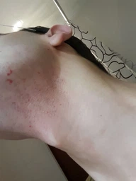 Сменные лезвия Philips OneBlade QP225/50 для сверхчувствительной кожи 2 шт (884722550870) фото от покупателей 6
