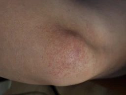 Пеларт Ампула локальної дії від пігментації Pelart Ampoule For Local Application For Whiting Effect, 2 мл