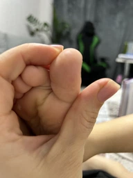 Электрокоагулятор для удаления папиллом и бородавок YP03 Белая + блок питания и иглы в Подарок (00-0000720) фото от покупателей 4