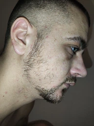 5% Minoxidil Kirkland для росту волосся та бороди (3 флакона + дозатор) фото від покупців 12