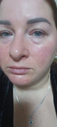 Сыворотка SKIN1004 Madagascar Centella Ampoule успокаивающая с центеллой 30 мл фото от покупателей 3