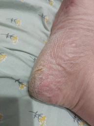 Пемза пилка для ног и пяток роликовая аккумуляторная Callus Remover 3W электрическая для шлифовки электропемза для педикюра USB зеленая фото от покупателей 17