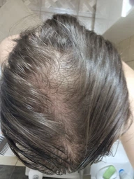 Сыворотка L'Oreal Paris Elseve Growth Booster для борьбы с выпадением и ломкостью волос 102 мл (3600524198367)