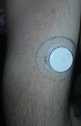 Сенсор постоянного мониторинга уровня глюкозы в крови Sinocare CGM i3 фото от покупателей 4