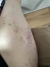 Массажер вакуумный 6 режимов Cupping Massage Pro аккумуляторный + масло 1 шт зеленый фото от покупателей 10