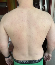 Мыло-уход для глубокого очищения кожи лица Biotrade ACNE OUT 100 г (3800221840204) фото от покупателей 1
