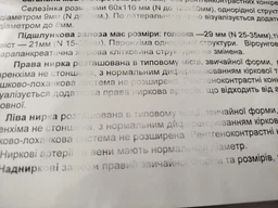 Картридж Dayton для HP/Canon CB435A/CB436A/CE285A/712/713/725 (DN-HP-NT435)