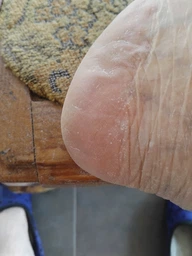 Пемза пилка для ног и пяток роликовая аккумуляторная Callus Remover 3W электрическая для шлифовки электропемза для педикюра USB розовая фото от покупателей 4