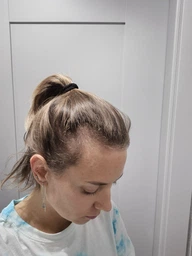 Сыворотка L'Oreal Paris Elseve Growth Booster для борьбы с выпадением и ломкостью волос 102 мл (3600524198367) фото от покупателей 1