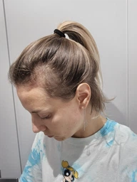 Сыворотка L'Oreal Paris Elseve Growth Booster для борьбы с выпадением и ломкостью волос 102 мл (3600524198367)