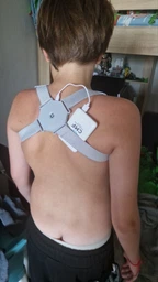 Корсет для спины позвоночника Nuoyi Miao Smart Senssor Corrector умный корректор осанки фото от покупателей 4