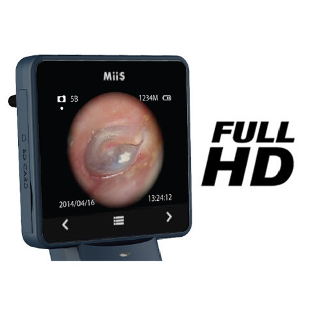 Отоскоп цифровий MIIS EOC100 Horus Digital Otoscope Full HD для діагностики слухового каналу (mpm_00255) - зображення 2
