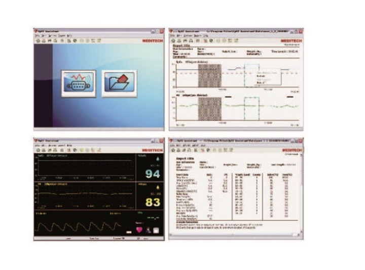 Пульсоксиметр Meditech FOs3 plus - зображення 3