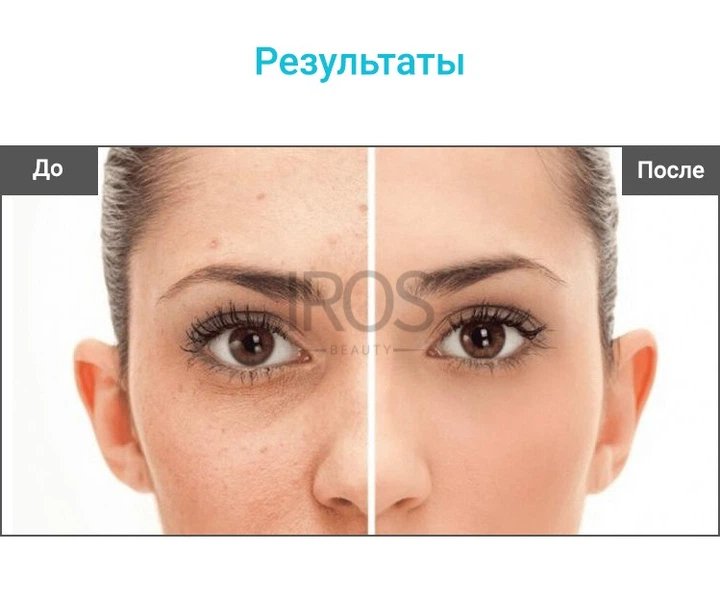 Массажер для лица RF лифтинга микротоковый с функцией фототерапии и EMS прибор для омоложения и подтяжки SUYANMEI SY-034 - изображение 9
