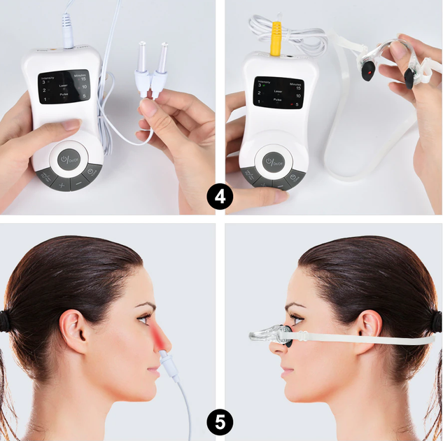 Аппарат для Лечения Аллергии и Ринита Hailicare (5001865) - изображение NaN