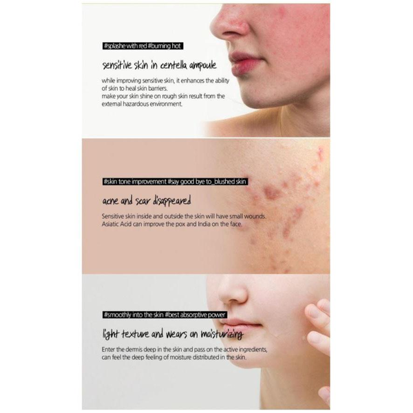 Сыворотка SKIN1004 Madagascar Centella Ampoule успокаивающая с центеллой 30 мл - Фото 3 Сыворотка SKIN1004 Madagascar Centella Ampoule успокаивающая с центеллой 30 мл - изображение 3