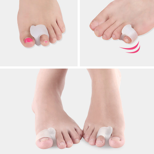 Силиконовый Разделитель для Большого Пальца Ноги Clefers BigToeSep 1 пара (5002101) - изображение 3