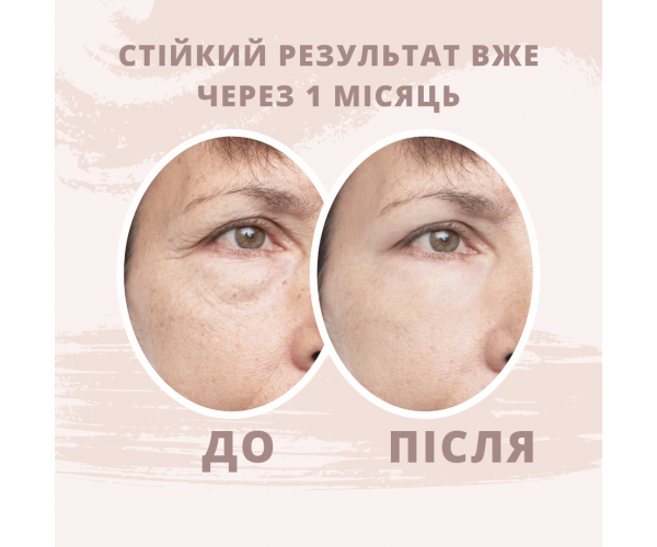 Кинезио тейп для лица Ares Beauty 5см х 5м - изображение 6
