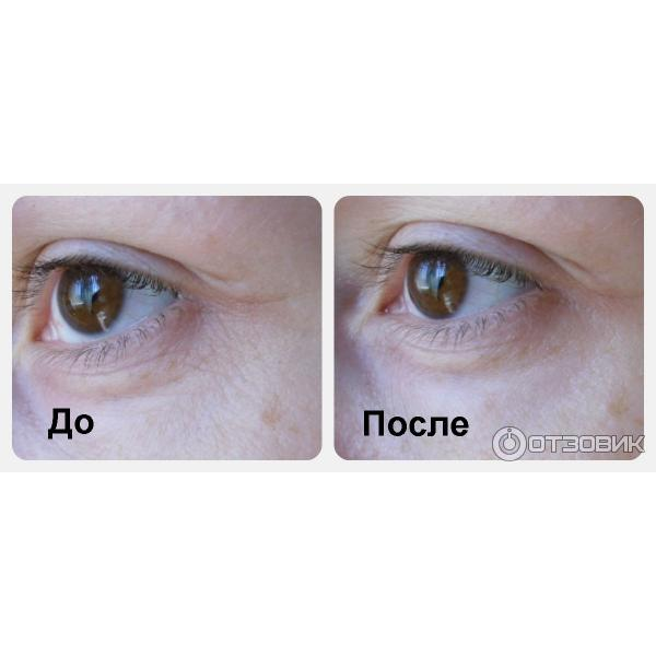Патчи Purederm Collagen Eye Zone Mask тканевые омолаживающие, 30 шт - изображение 3