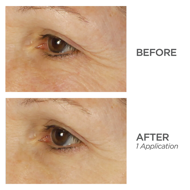 Гидрогелевые патчи с коллоидным серебром BeautyBio Bright Eyes Depuffing and Brightening Eye Gels 1 пара - Фото 5 Гидрогелевые патчи с коллоидным серебром BeautyBio Bright Eyes Depuffing and Brightening Eye Gels 1 пара - изображение 5