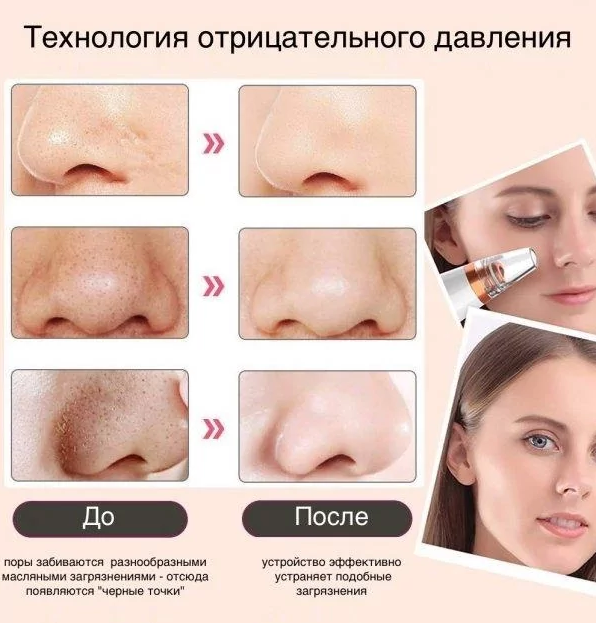 Аппарат для вакуумной глубокой чистки пор лица Multi-Functional - изображение 6