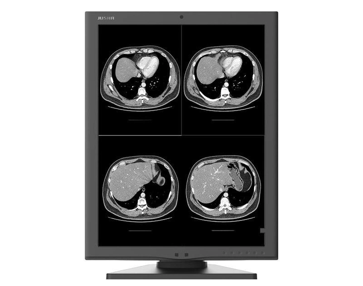 Діагностичний медичний монітор JUSHA-M260G (2МП, монохромний, діагональ 21,3 дюйми, для рентгенографії, МРТ, КТ, ангіографії) - зображення 2